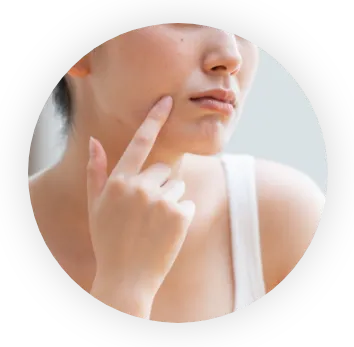 肌荒れもひどく改善したい